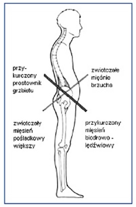 skrzyżowanie dolne